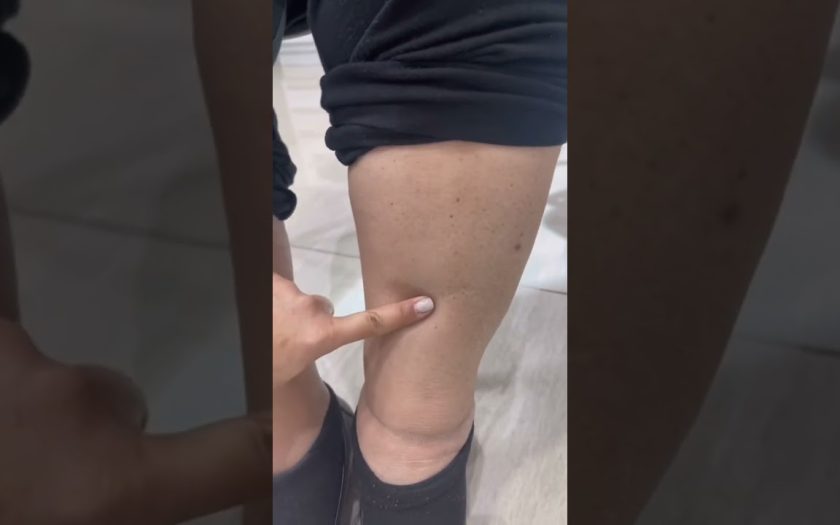 Por qué el desagüe funciona mal solo a ciertas horas